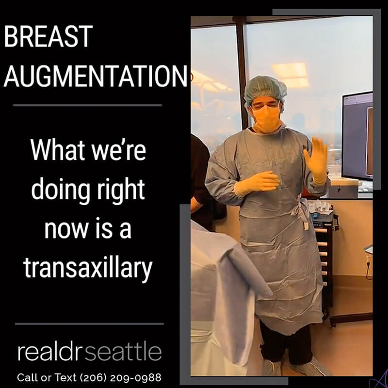 Transgender Breast Augmentation 600cc Silicone Implantsr