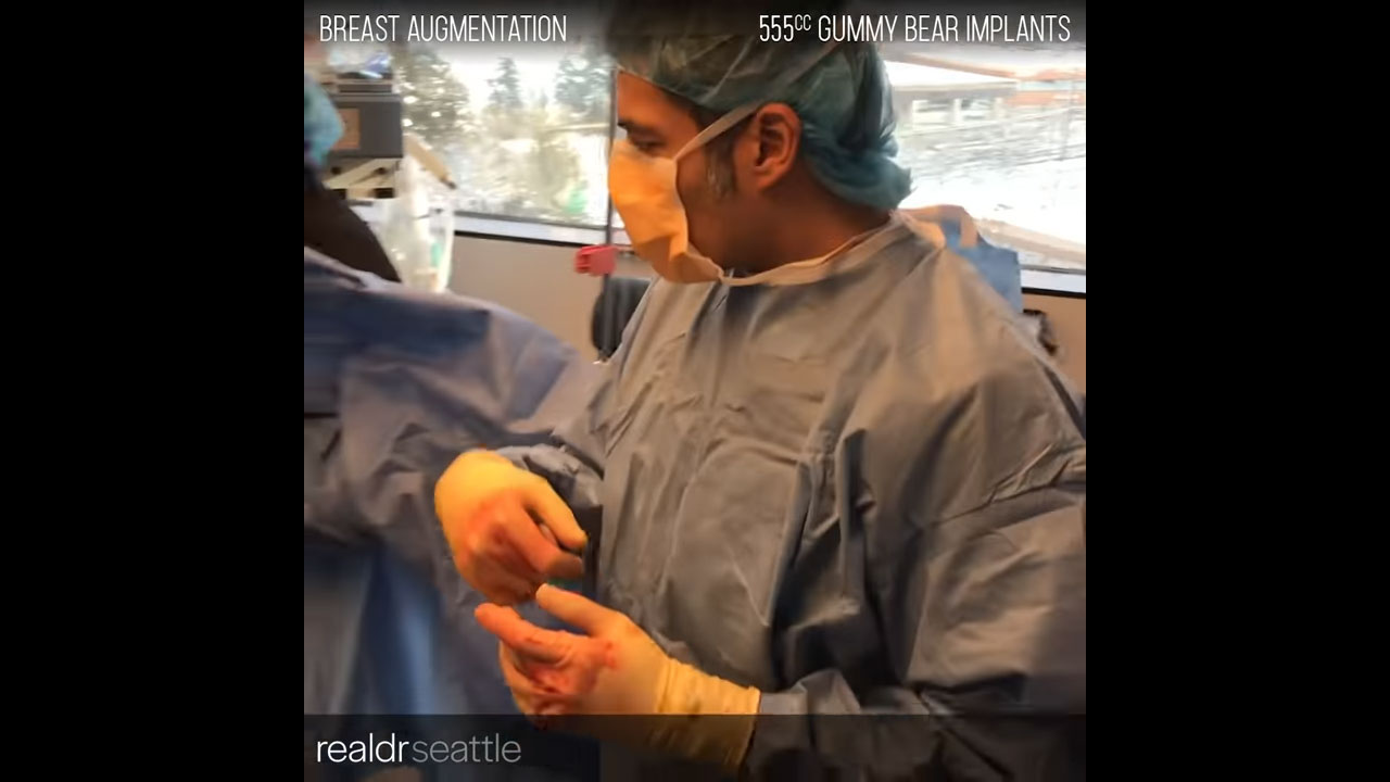 Breast Augmentation