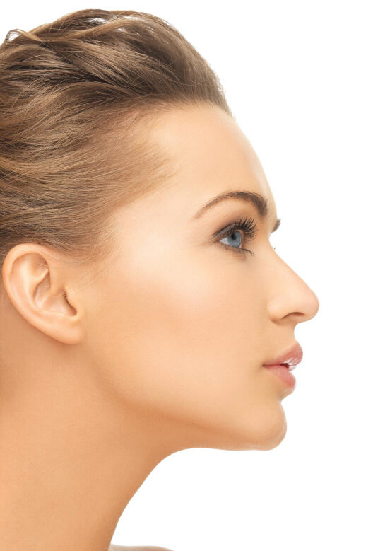 Rhinoplasty 02
