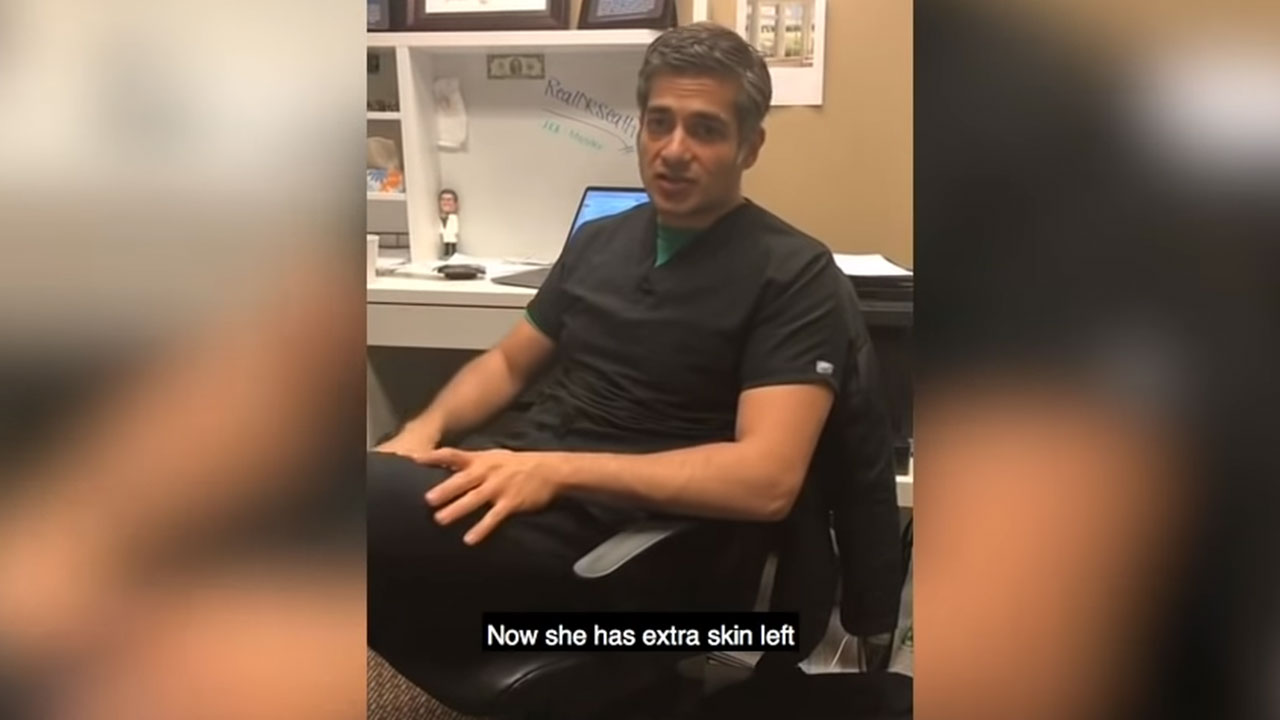 Arm Lift Brachioplasty Plastic Surgery