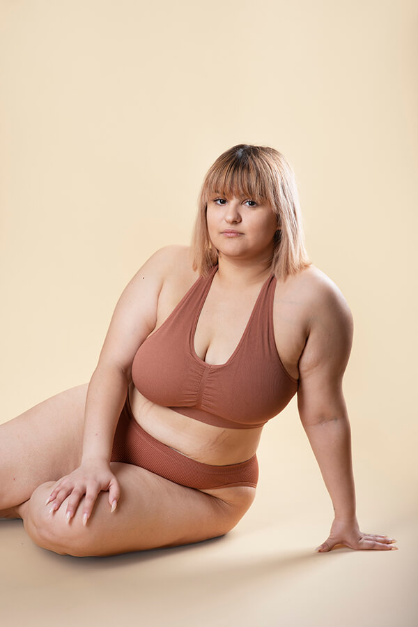 Lipedema Liposuction Seattle 1