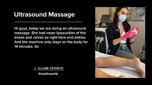 Ultrasound Massage For A Better Post Surgery Recovery After Liposuction Video Poster