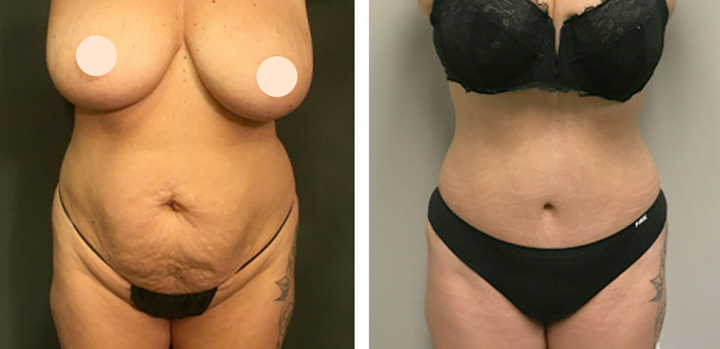 Before & After Gallery