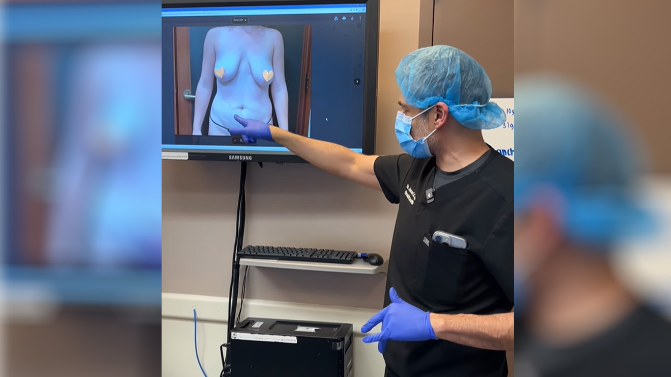 Tummy Tuck W Breast Lift Thumbnail