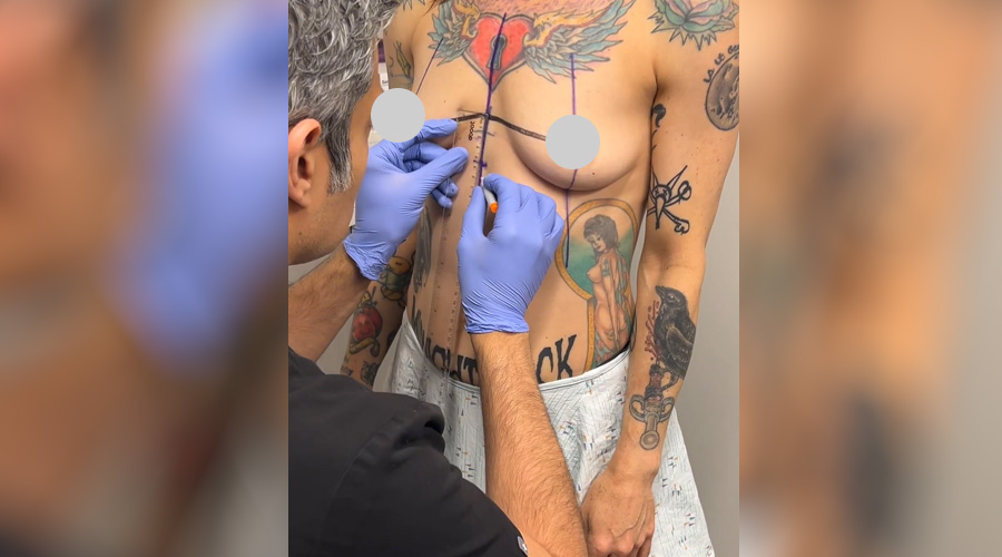 Video Thunbnail Dual Plane