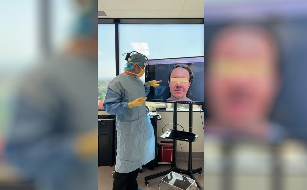 Lower Face Contouring Video Thumbnail