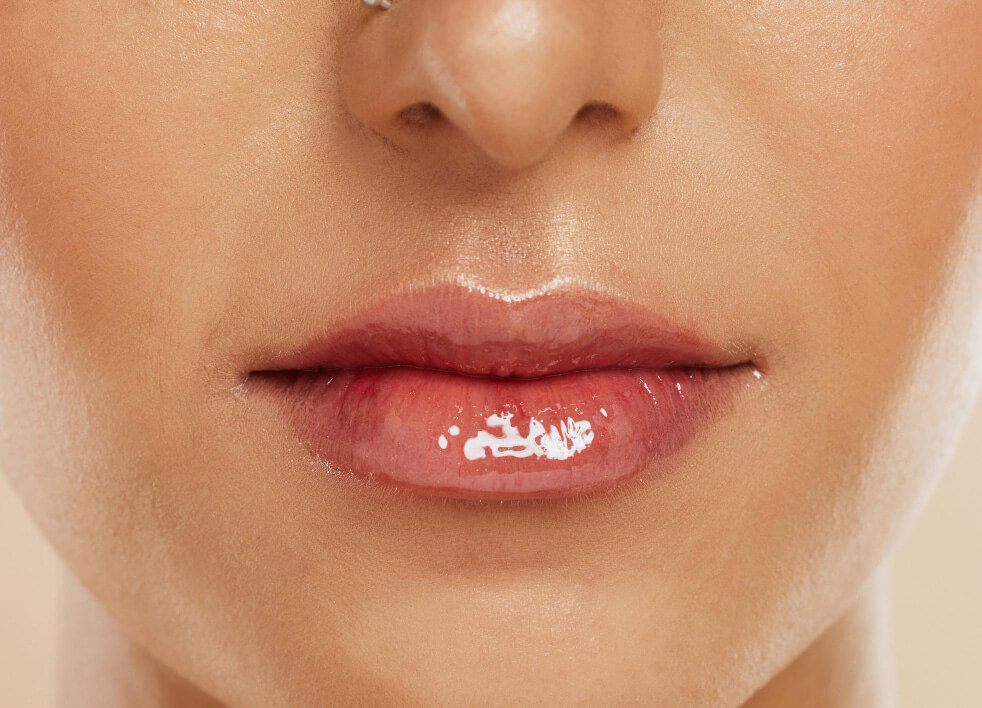 How the Direct Lip Lift Works