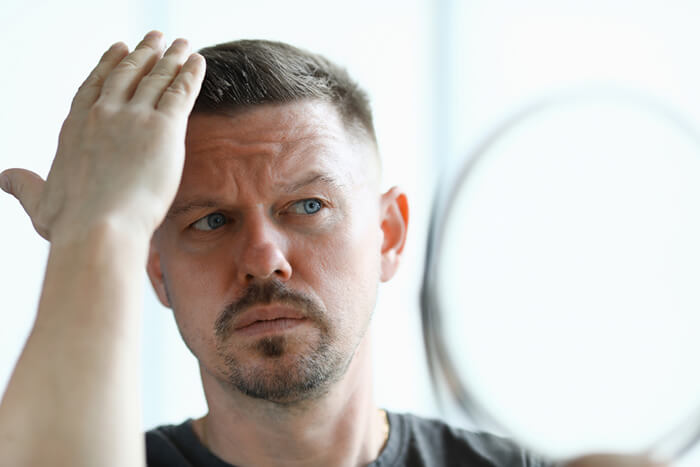 Botox For Hair Loss 02