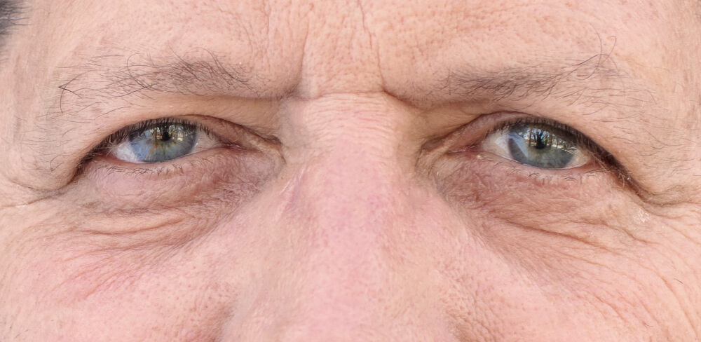 Finding The Right Botox Expert In Seattle