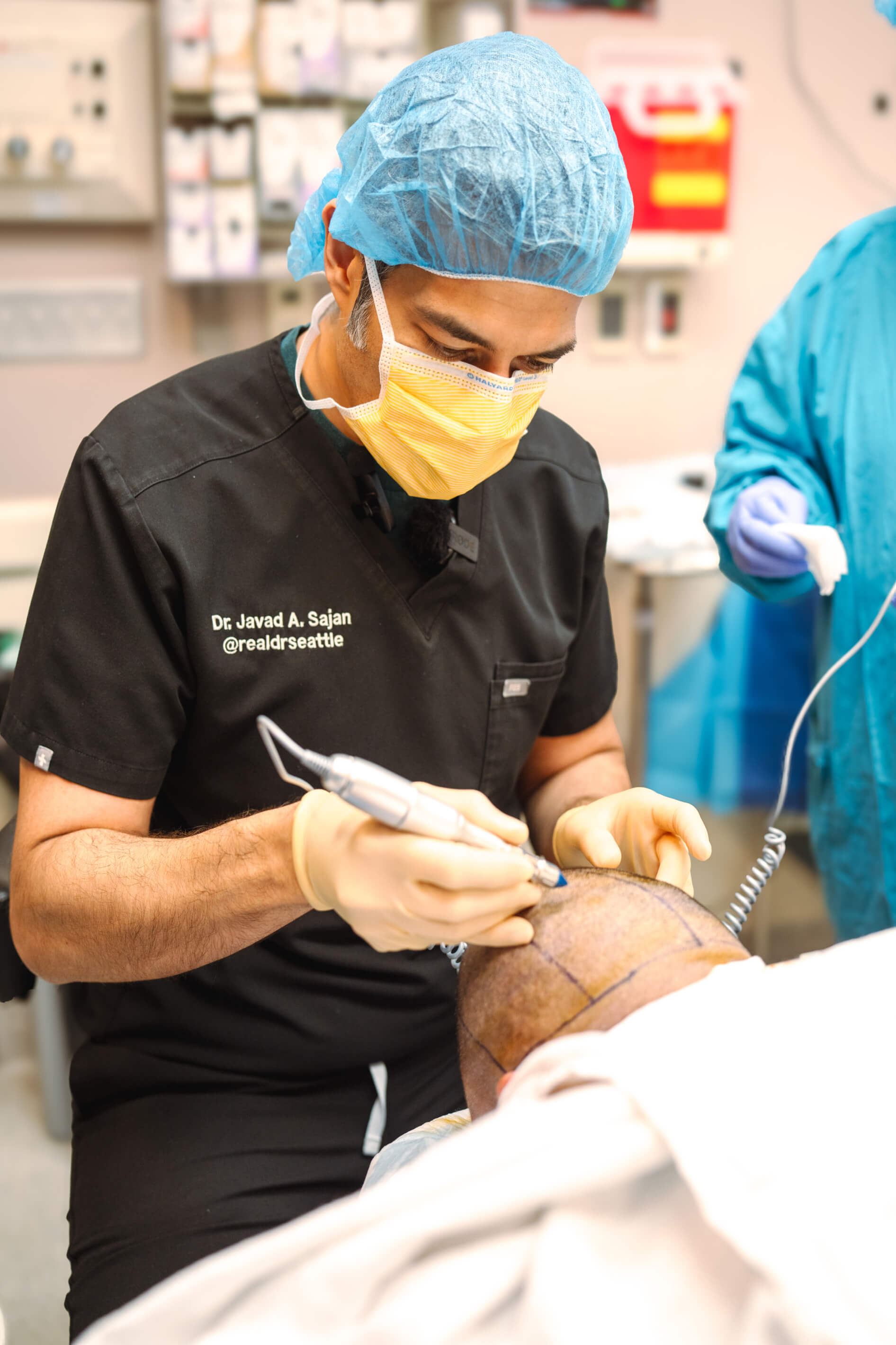 Neograft Hair Transplants In Seattle 02