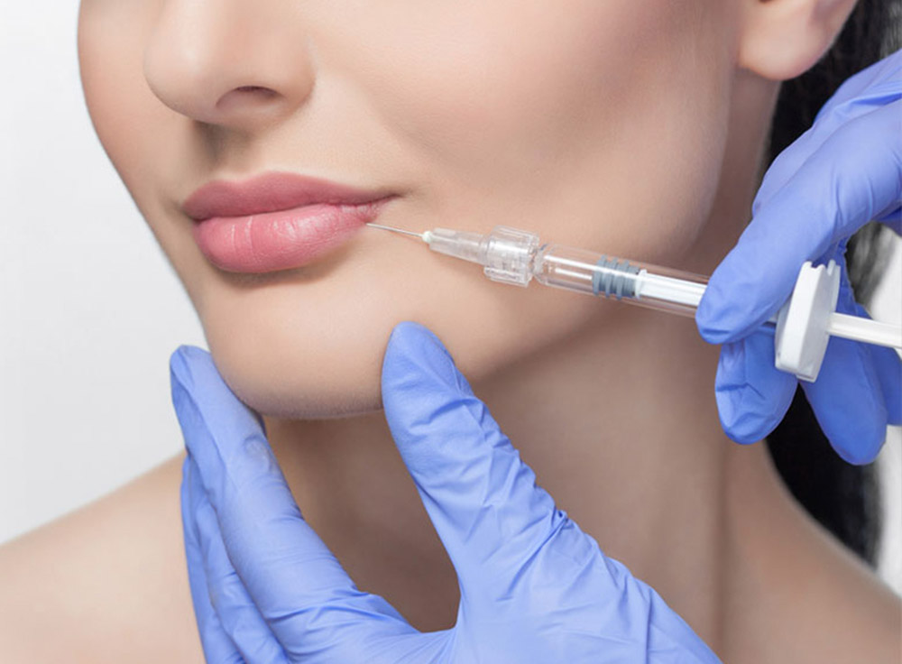 Lip Filler Augmentation