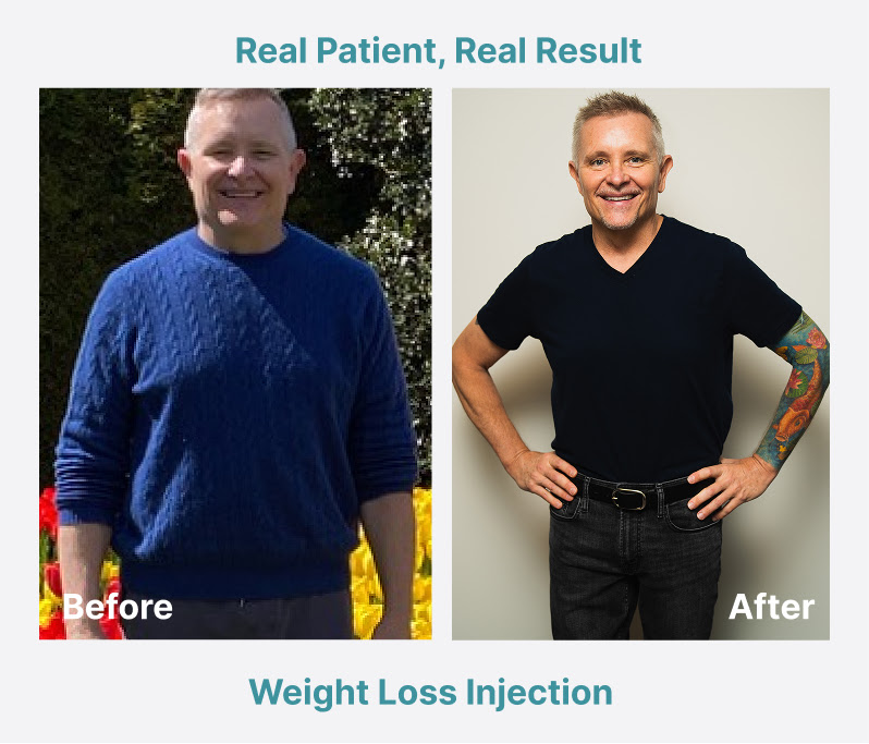 Weight Loss Before/After Photo