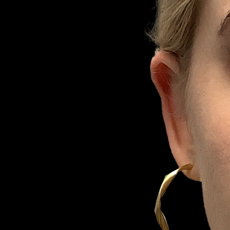 Extended Bilateral Otoplasty 02