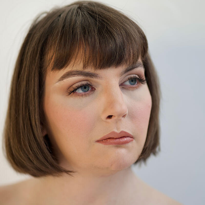 Facial Feminization 03