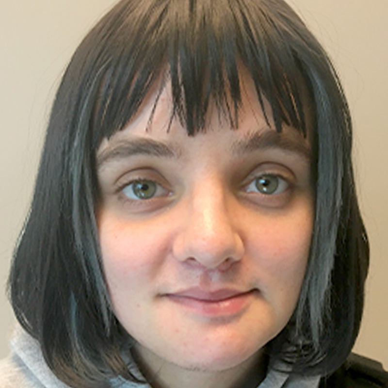 Facial Feminization 04