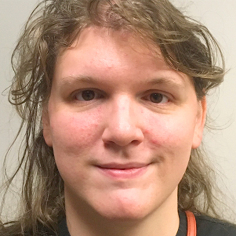 Facial Feminization 10