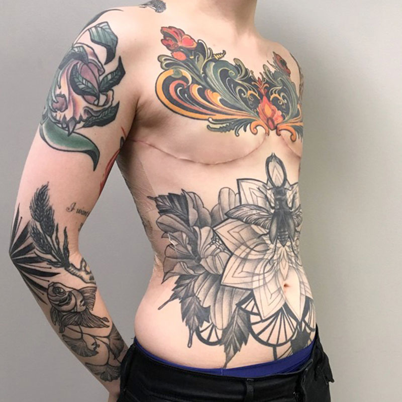 Female To Male Top Surgery 05