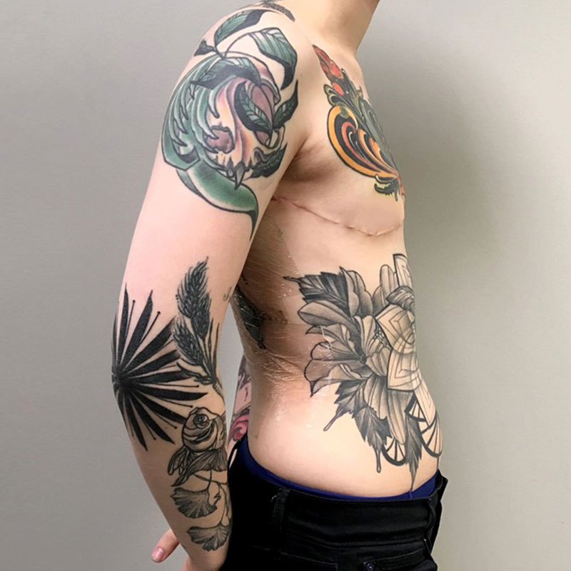 Female To Male Top Surgery 09