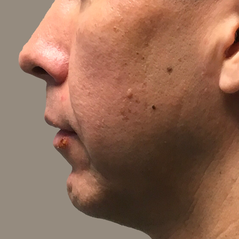 Injectables And Fillers 05