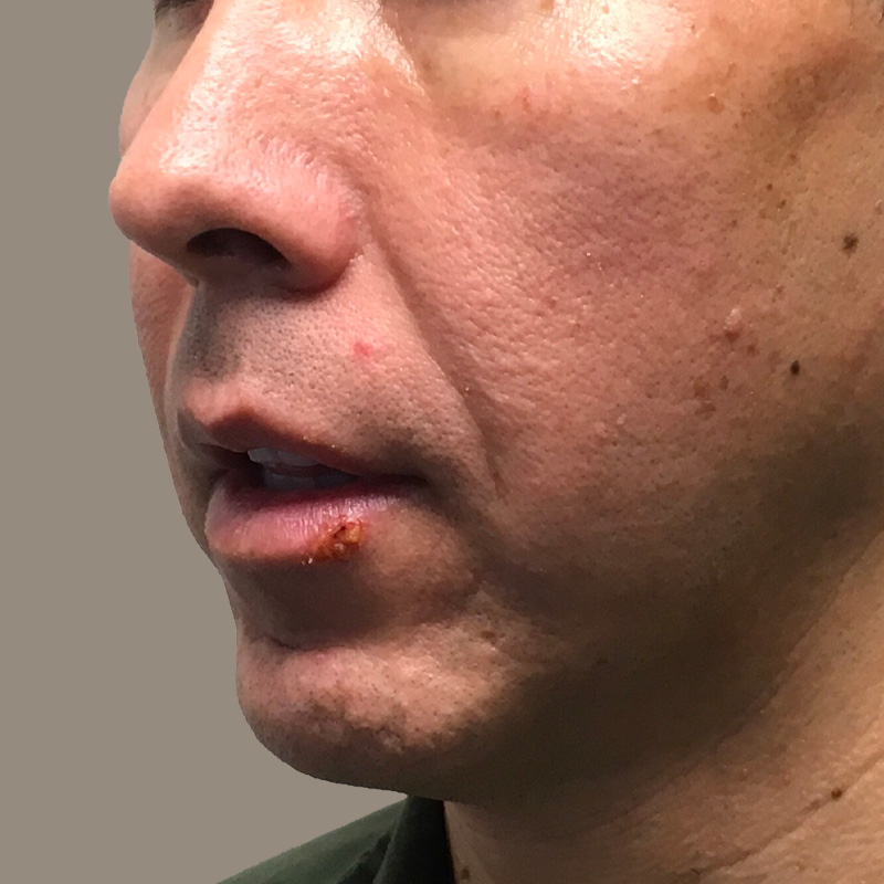 Injectables And Fillers 09