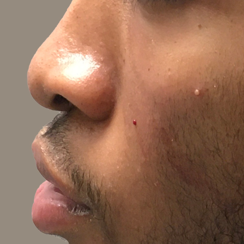 Injectables And Fillers 02