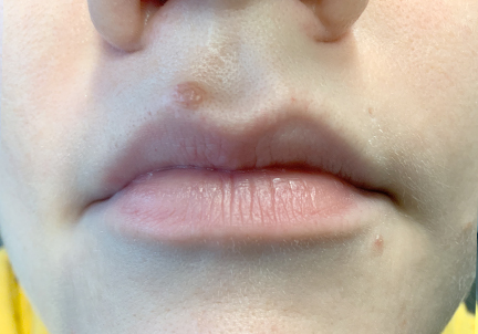 Injectables And Fillers 01