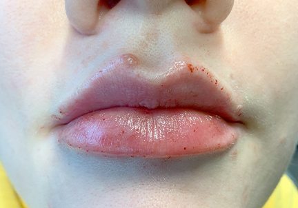 Injectables And Fillers 05