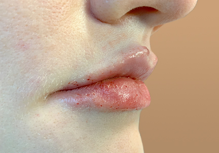 Injectables And Fillers 09