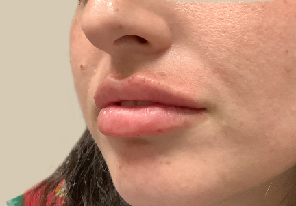 Injectables And Fillers 03