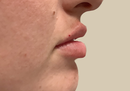 Injectables And Fillers 09