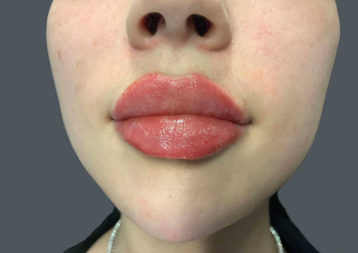 Injectables And Fillers 10