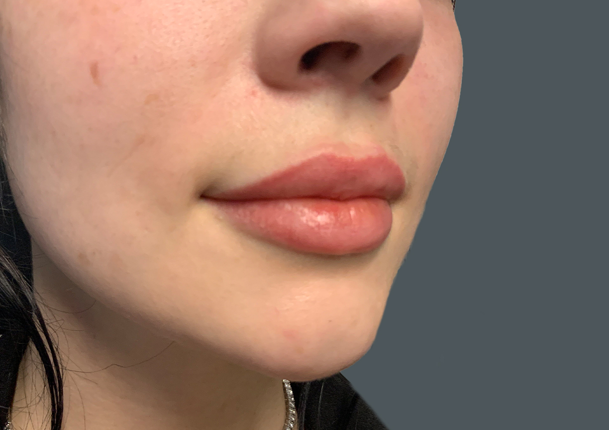 Injectables And Fillers 05