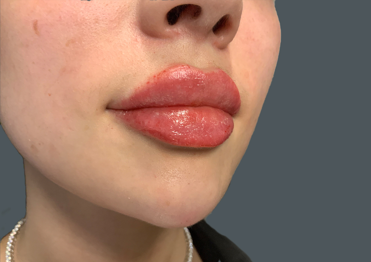 Injectables And Fillers 05