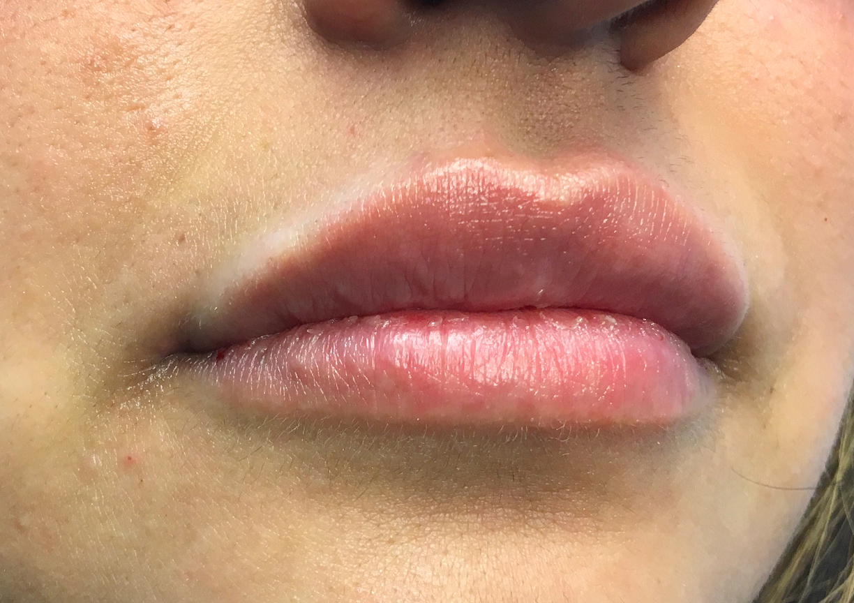 Injectables And Fillers 03