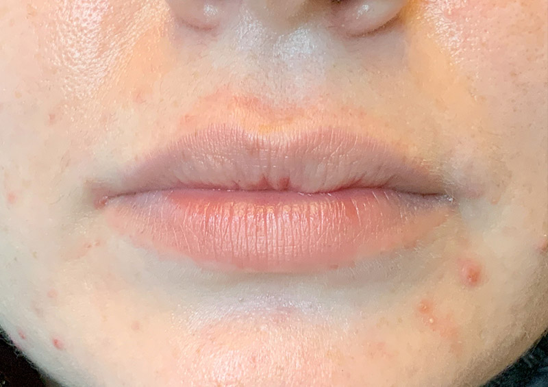 Injectables And Fillers 01