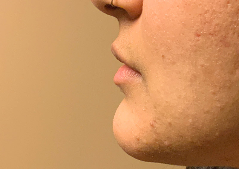 Injectables And Fillers 03