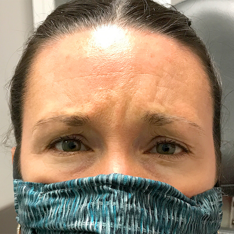 Injectables And Fillers 01