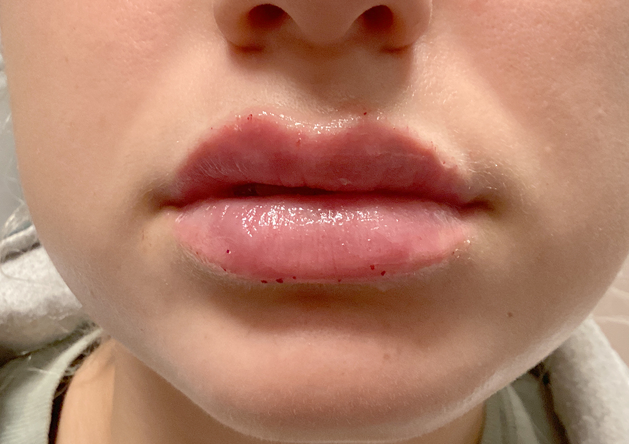 Injectables And Fillers 11