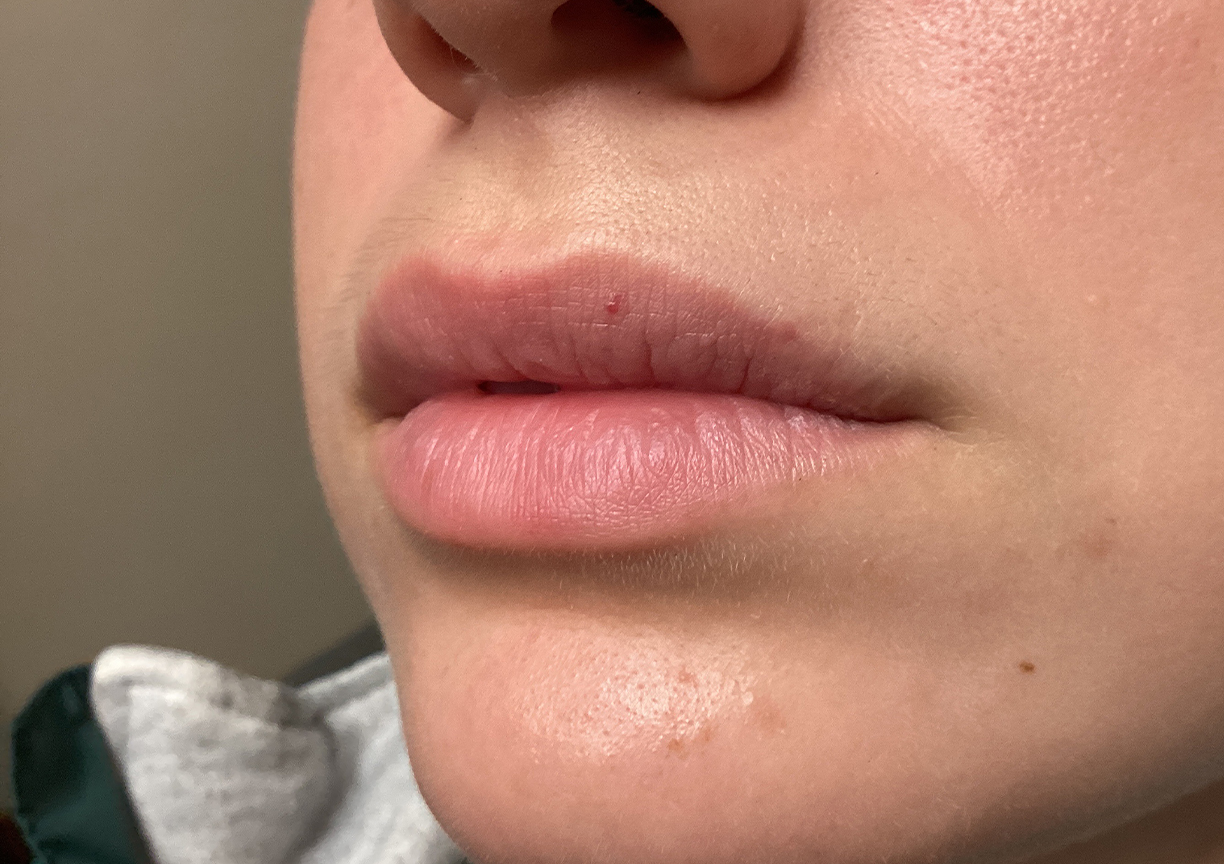 Injectables And Fillers 05