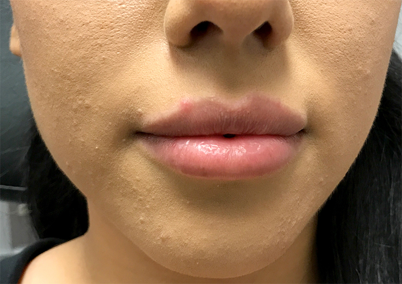 Injectables And Fillers 01