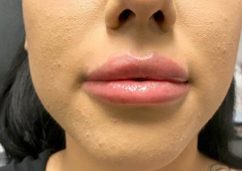 Injectables And Fillers 116