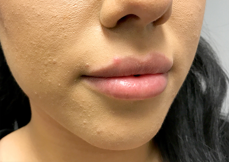 Injectables And Fillers 03