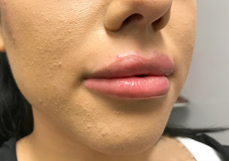 Injectables And Fillers 03