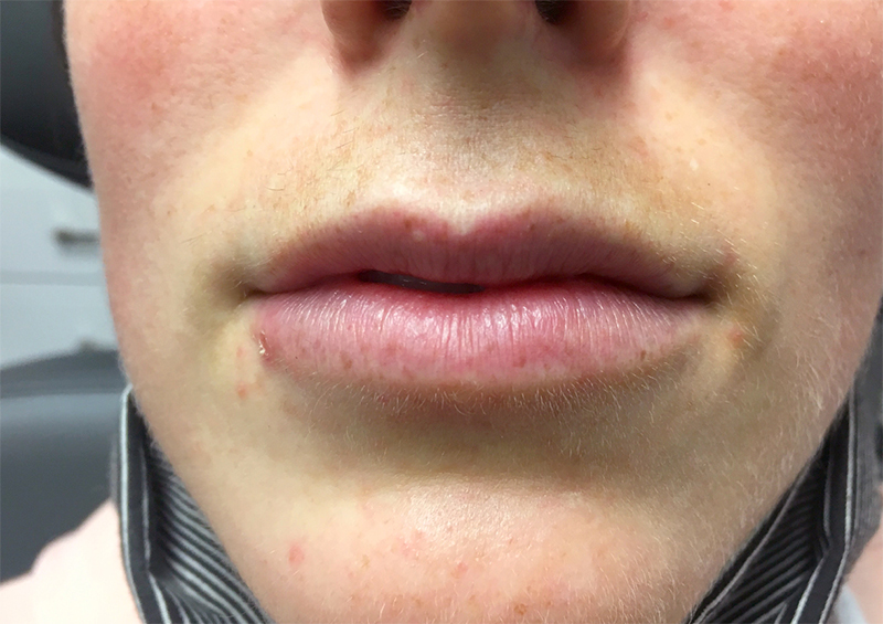 Injectables And Fillers 01