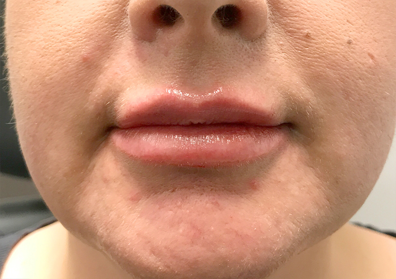 Injectables And Fillers 119