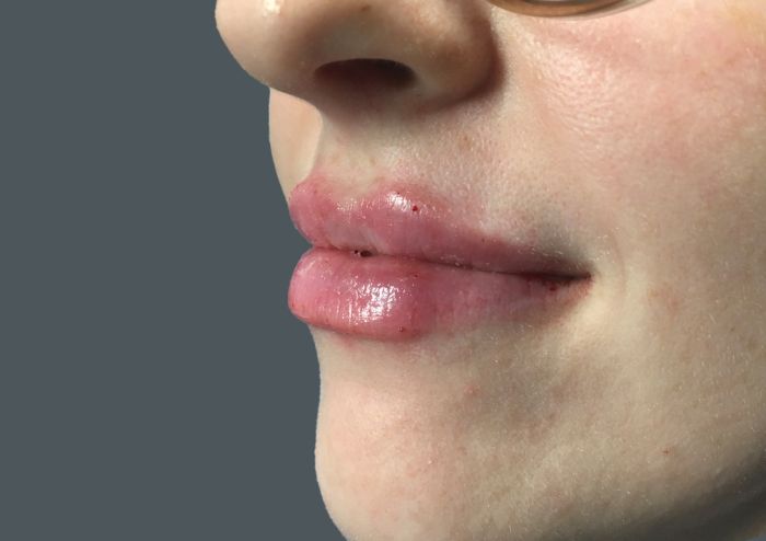 Injectables And Fillers 07