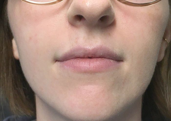 Injectables And Fillers 09