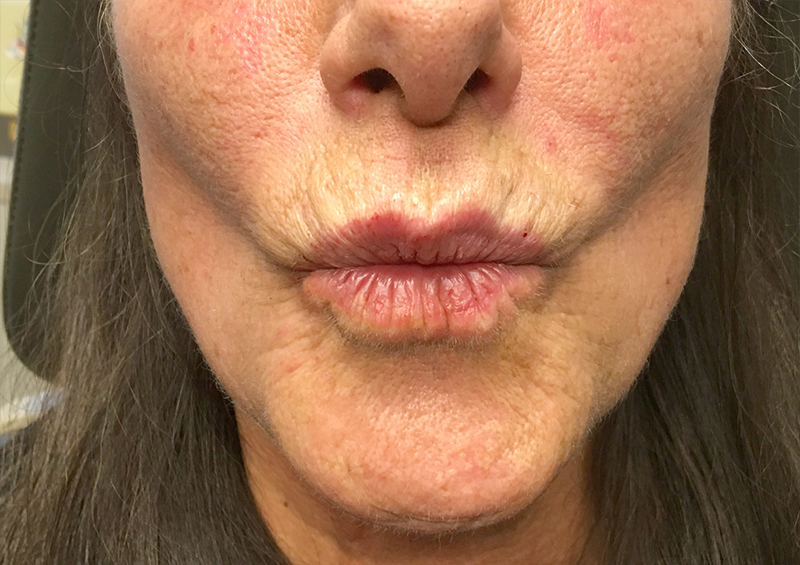 Injectables And Fillers 127