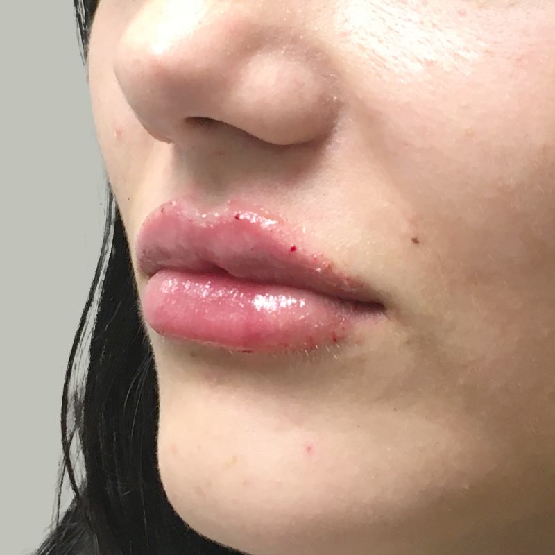 Injectables And Fillers 07