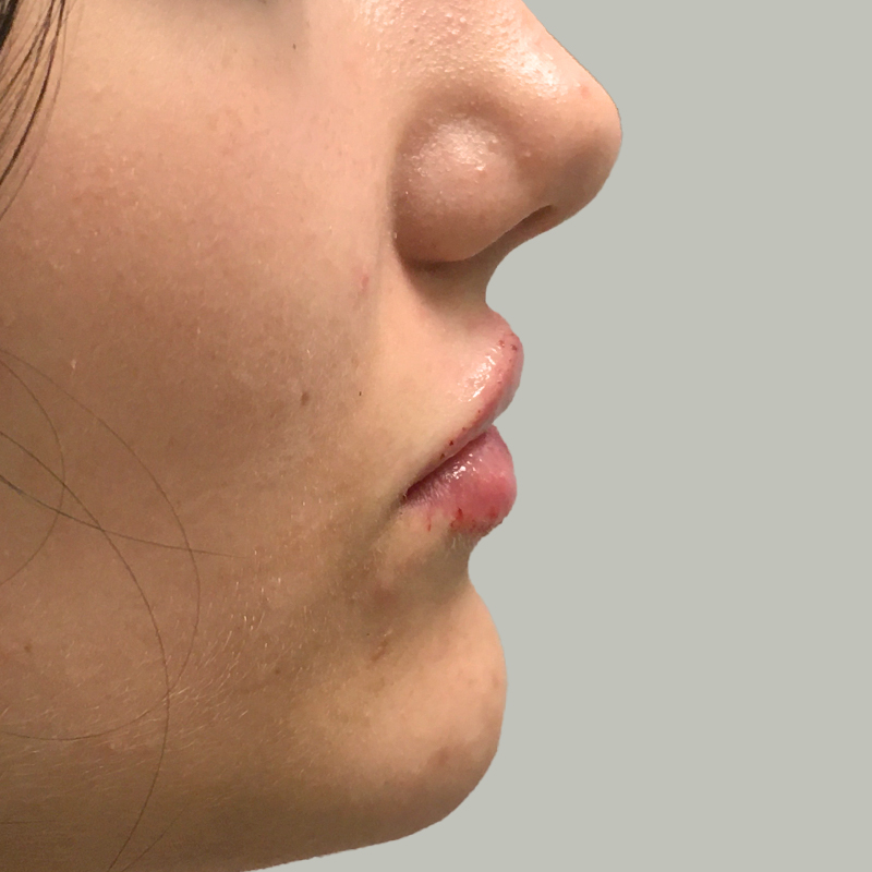 Injectables And Fillers 09